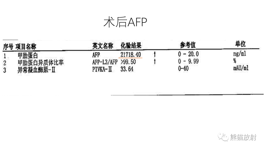 影像PPT - 【病例】腹膜后肾上腺区卵黄囊瘤1例CT影像-23