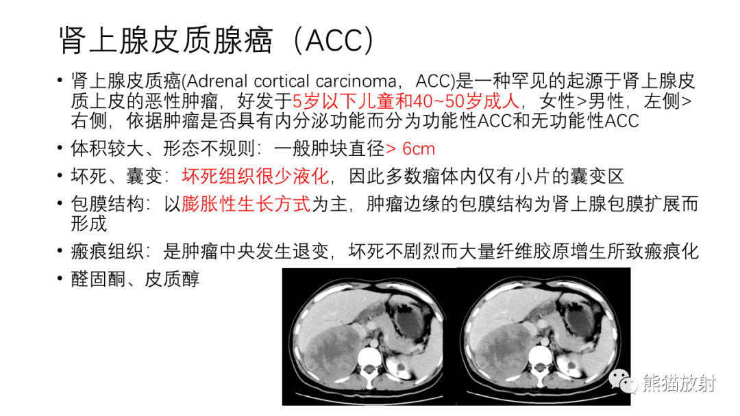 影像PPT - 【病例】腹膜后肾上腺区卵黄囊瘤1例CT影像-27