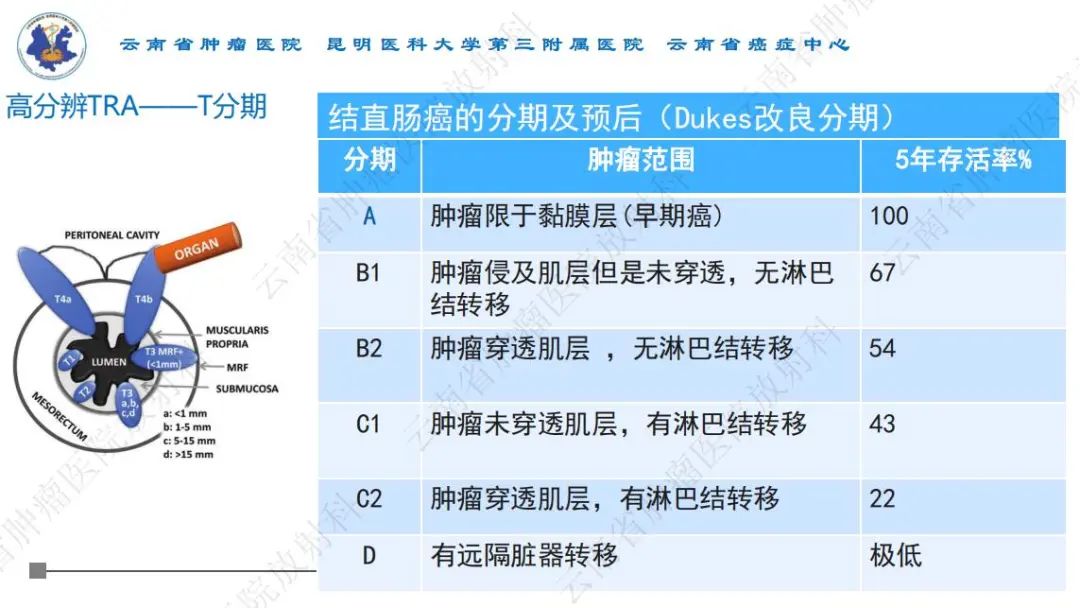 影像PPT - 【PPT】直肠癌磁共振解读-17