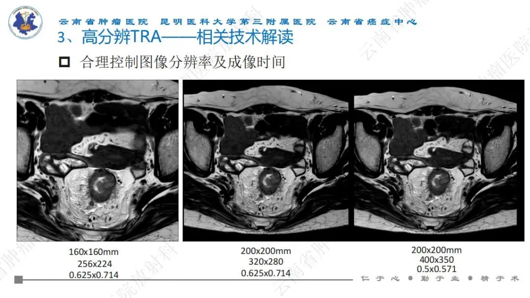 影像PPT - 【PPT】直肠癌磁共振解读-41