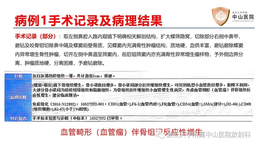 影像PPT - 【病例】颅骨血管畸形(血管瘤)2例CT及MR影像-6