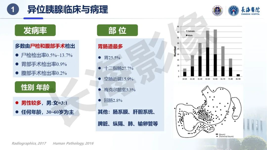 影像PPT - 【PPT】异位胰腺的影像特征及并发症-4