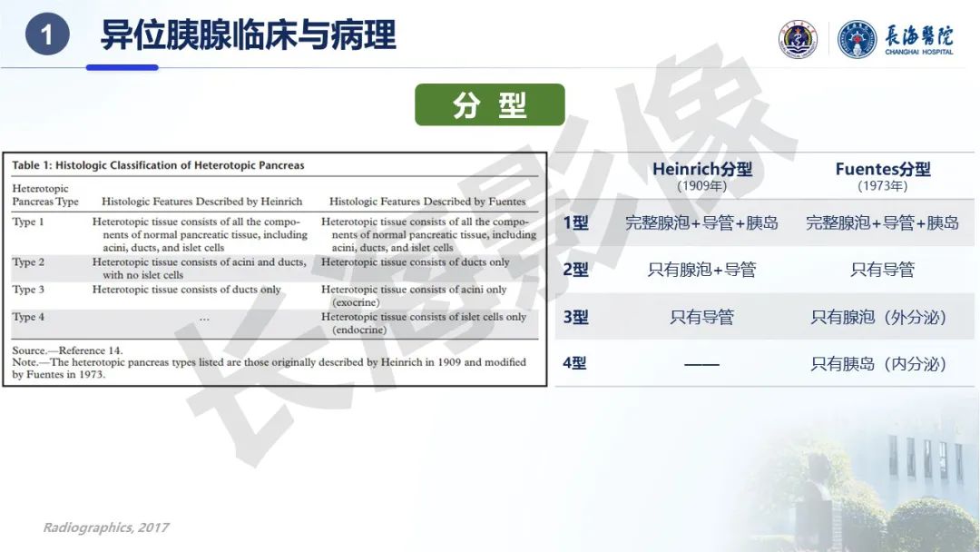 影像PPT - 【PPT】异位胰腺的影像特征及并发症-6