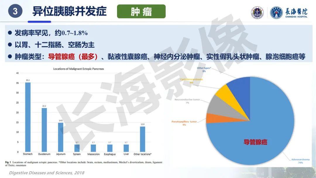 影像PPT - 【PPT】异位胰腺的影像特征及并发症-28
