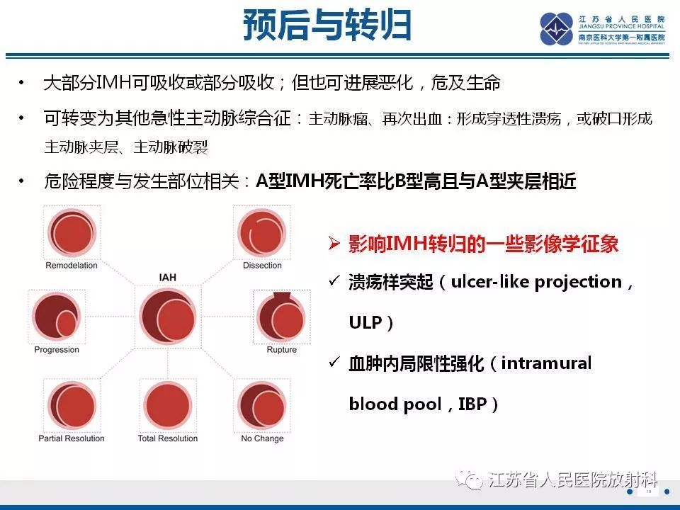 影像PPT - 【PPT】主动脉壁间血肿-20