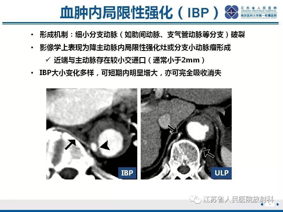 影像PPT - 【PPT】主动脉壁间血肿-22