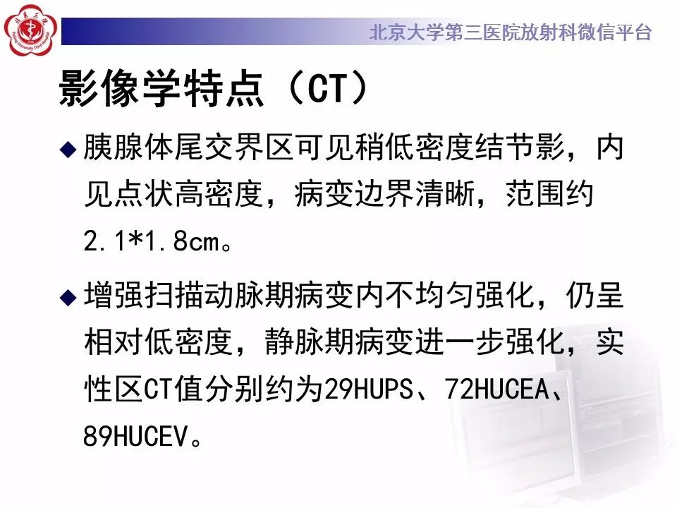 影像PPT - 【PPT】胰腺实性假乳头状肿瘤-12