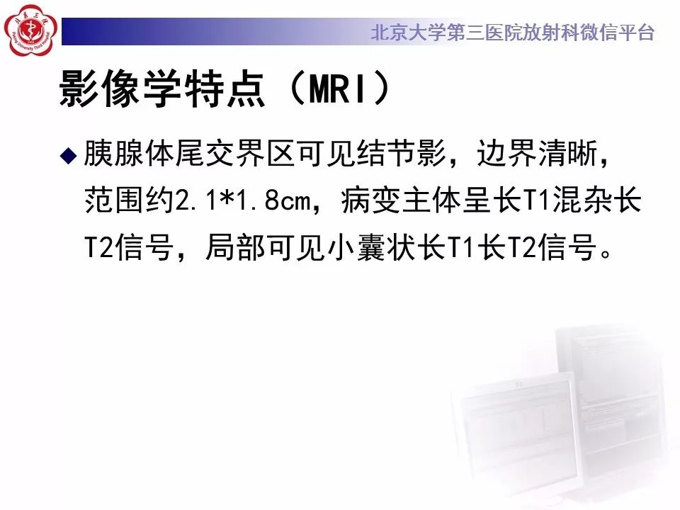 影像PPT - 【PPT】胰腺实性假乳头状肿瘤-13