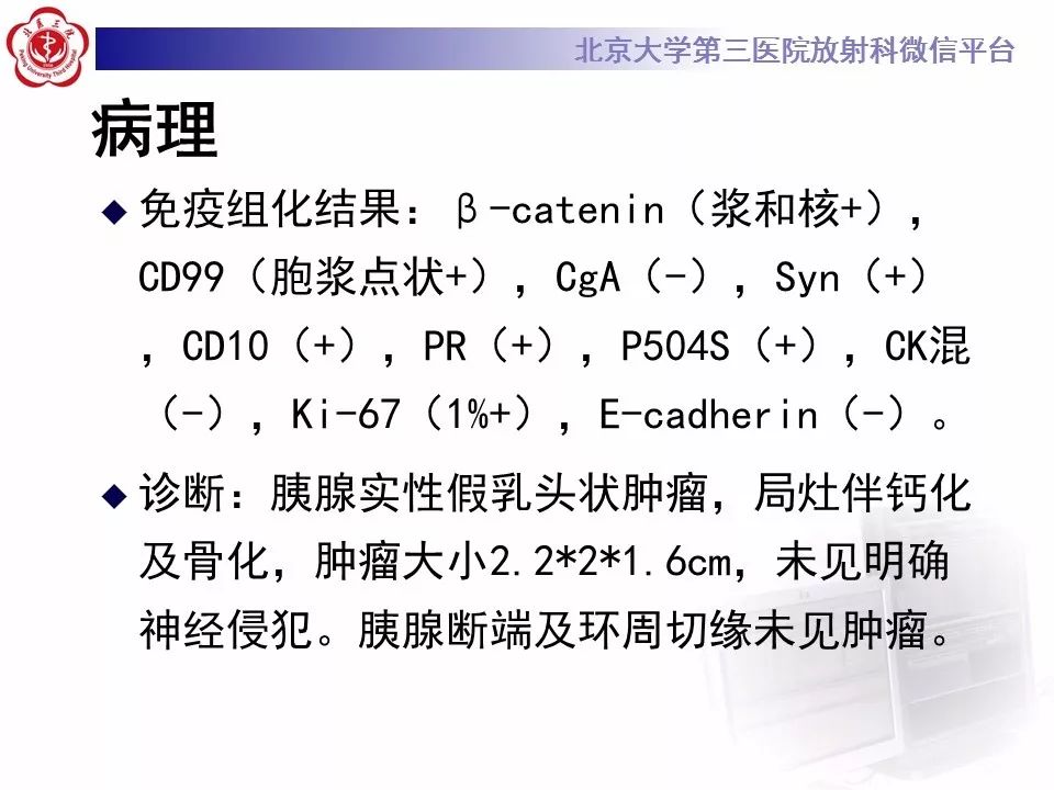 影像PPT - 【PPT】胰腺实性假乳头状肿瘤-15