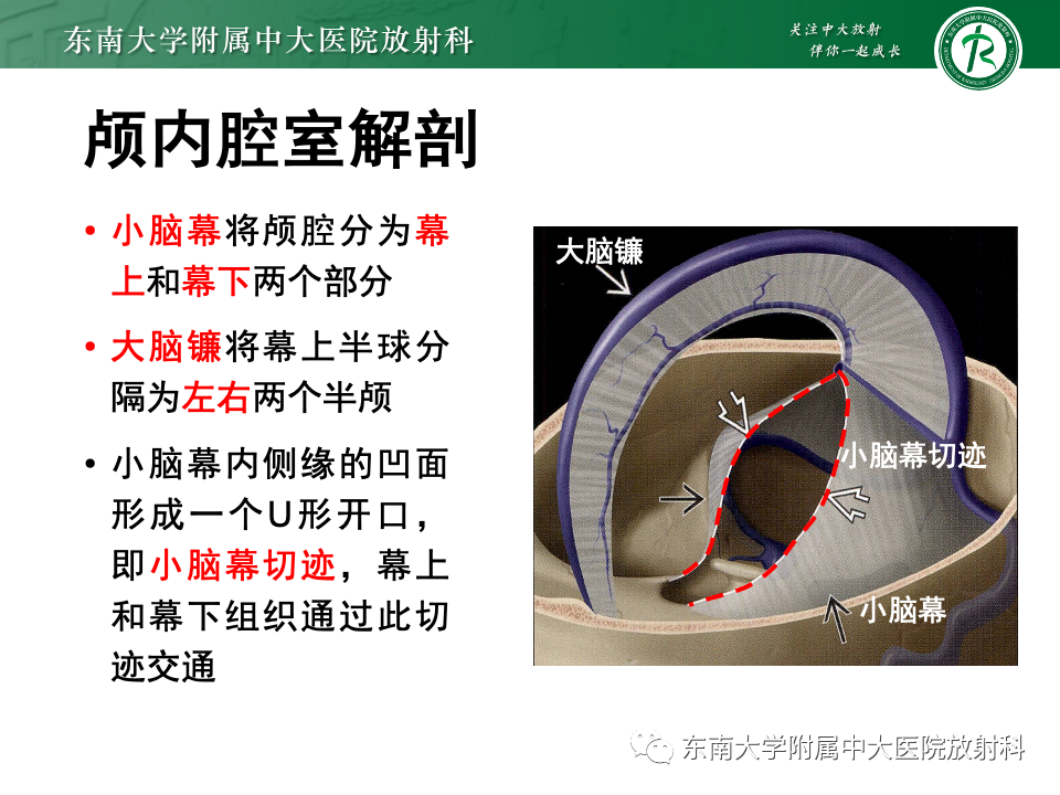 影像PPT - 【PPT】颅内疝-4