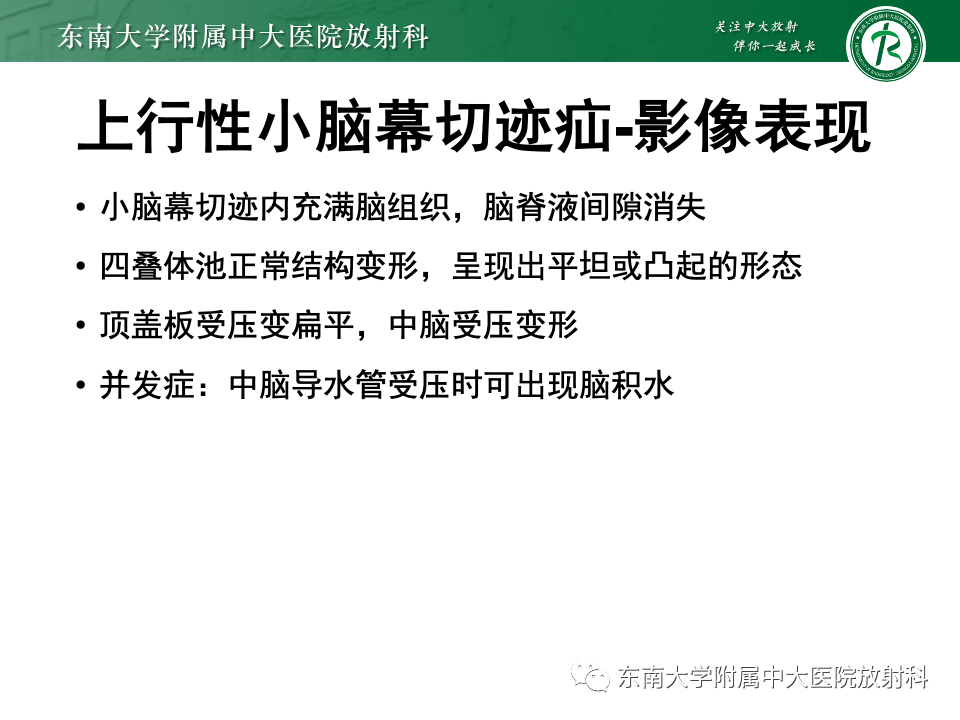影像PPT - 【PPT】颅内疝-26