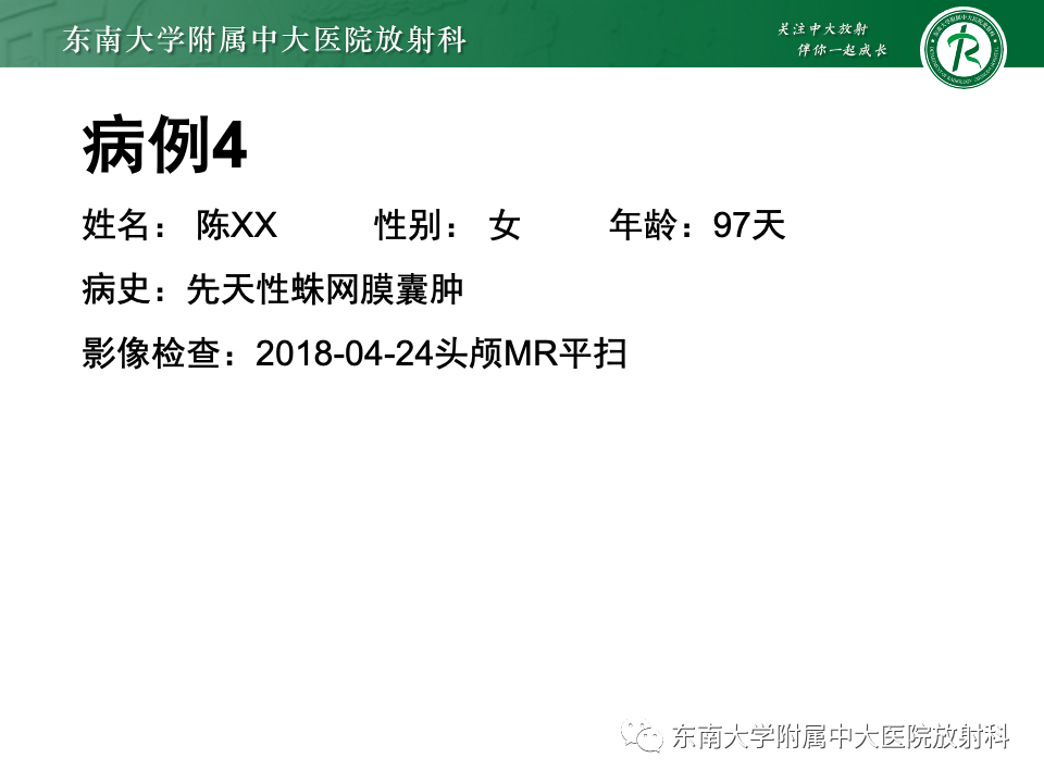 影像PPT - 【PPT】颅内疝-28