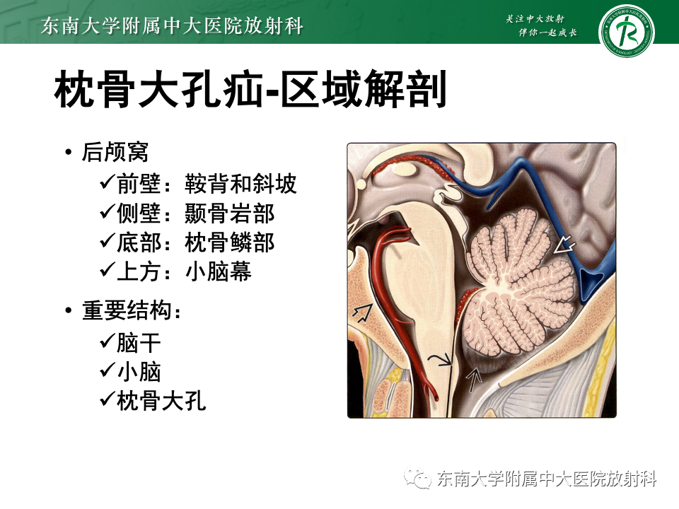 影像PPT - 【PPT】颅内疝-31