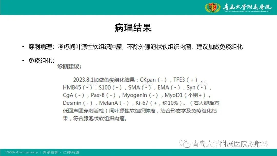 影像PPT - 【PPT】腺泡状软组织肉瘤-13