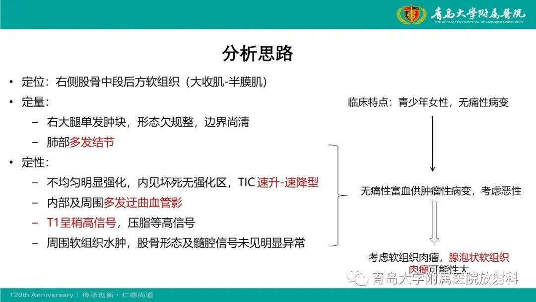 影像PPT - 【PPT】腺泡状软组织肉瘤-11