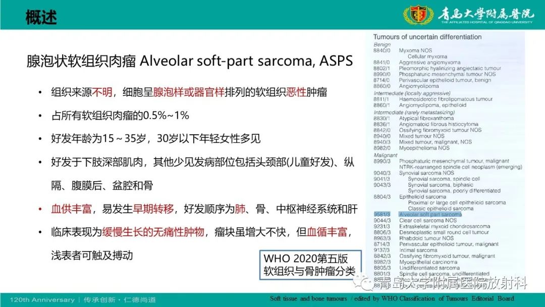 影像PPT - 【PPT】腺泡状软组织肉瘤-15