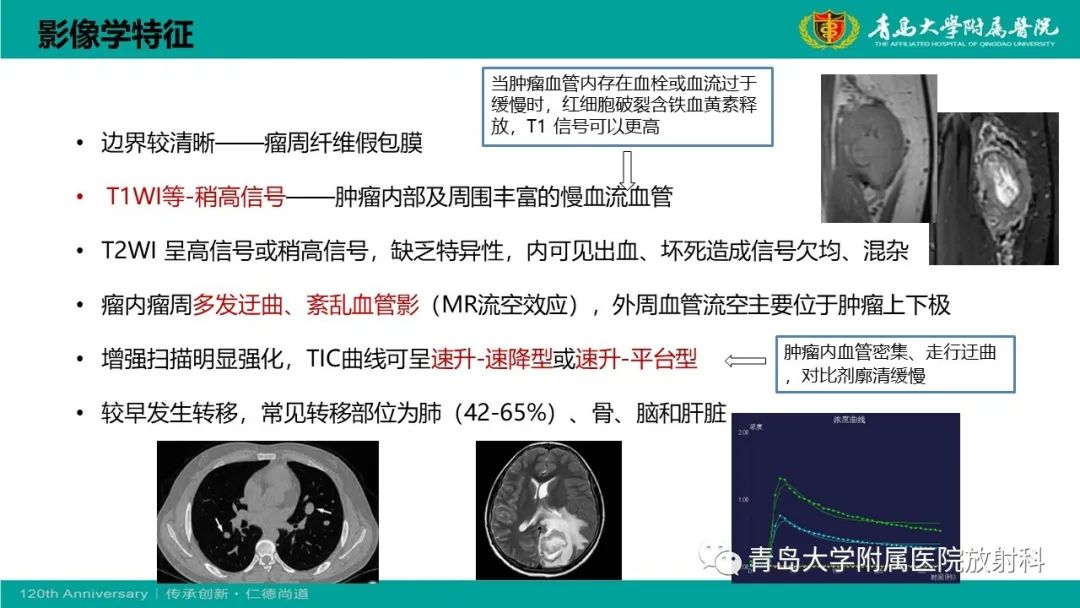 影像PPT - 【PPT】腺泡状软组织肉瘤-17