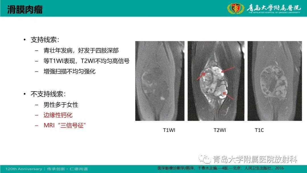 影像PPT - 【PPT】腺泡状软组织肉瘤-27