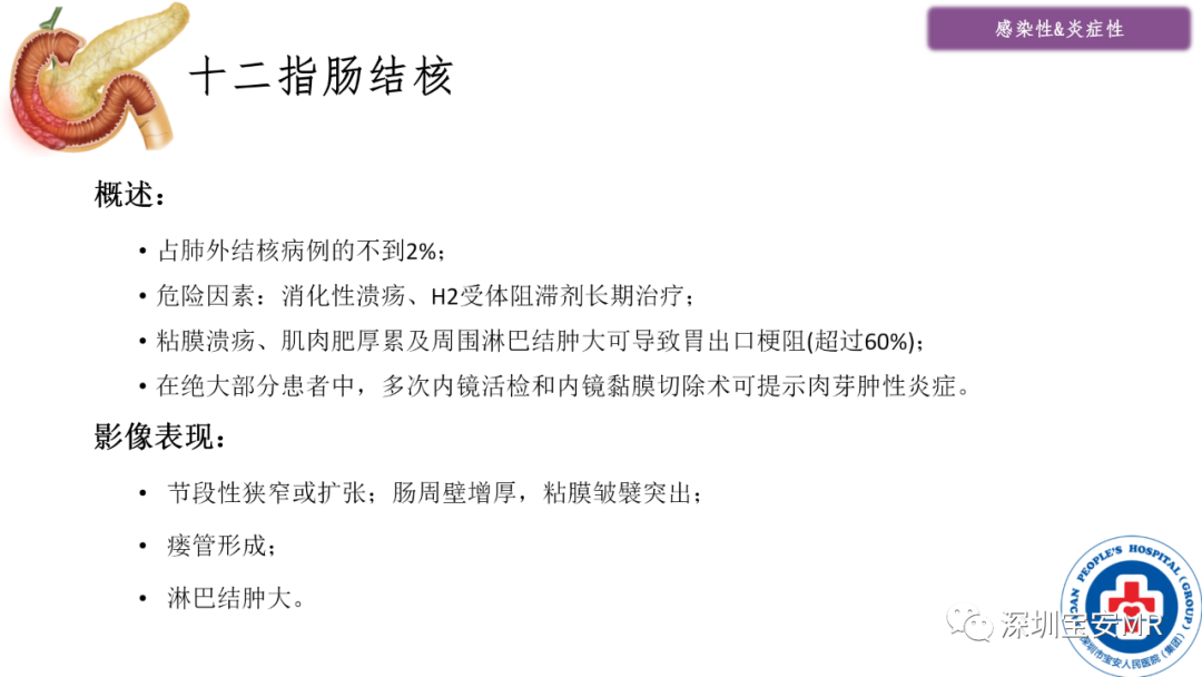影像PPT - 【PPT】十二指肠疾病影像表现-3