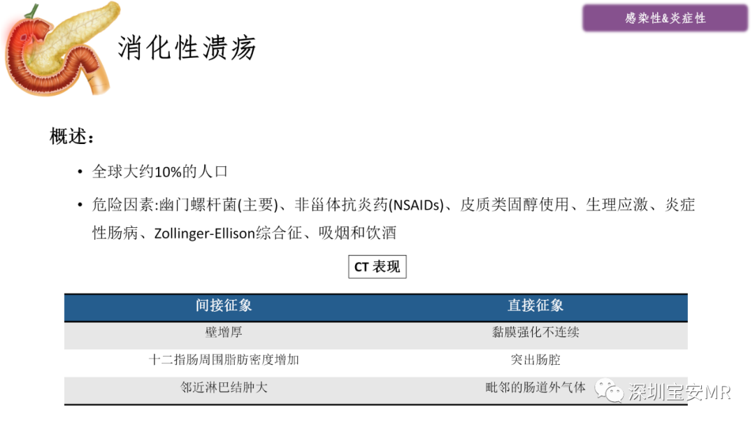 影像PPT - 【PPT】十二指肠疾病影像表现-5