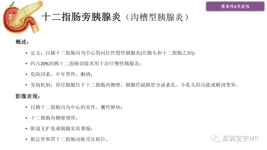 影像PPT - 【PPT】十二指肠疾病影像表现-7