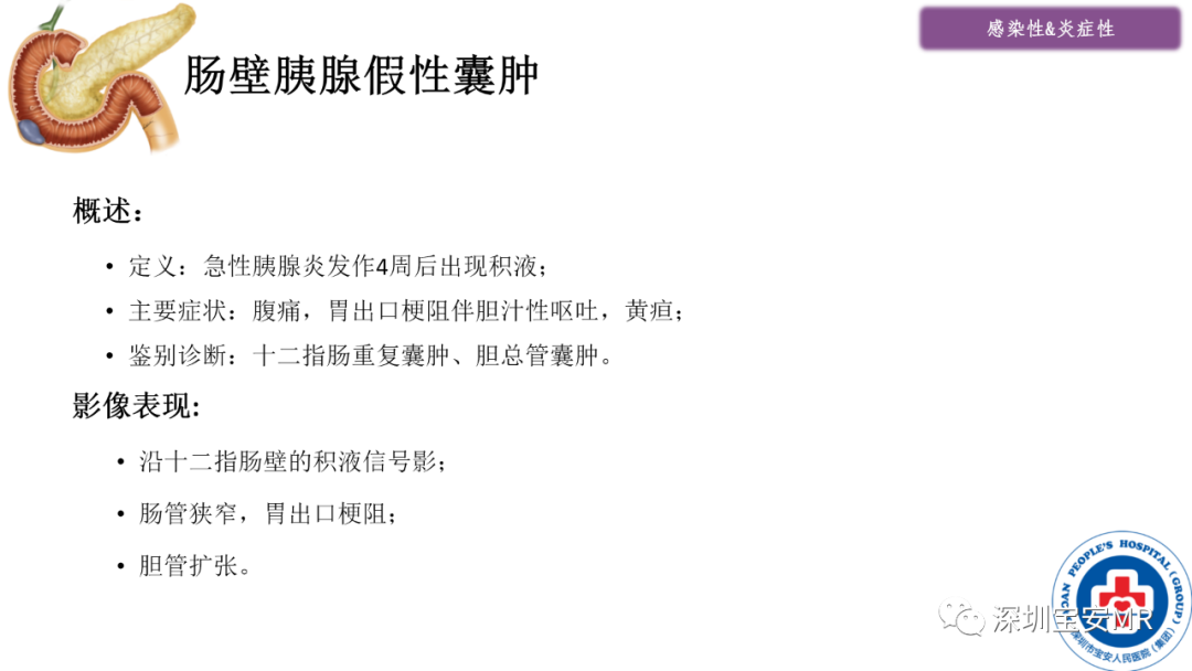 影像PPT - 【PPT】十二指肠疾病影像表现-9