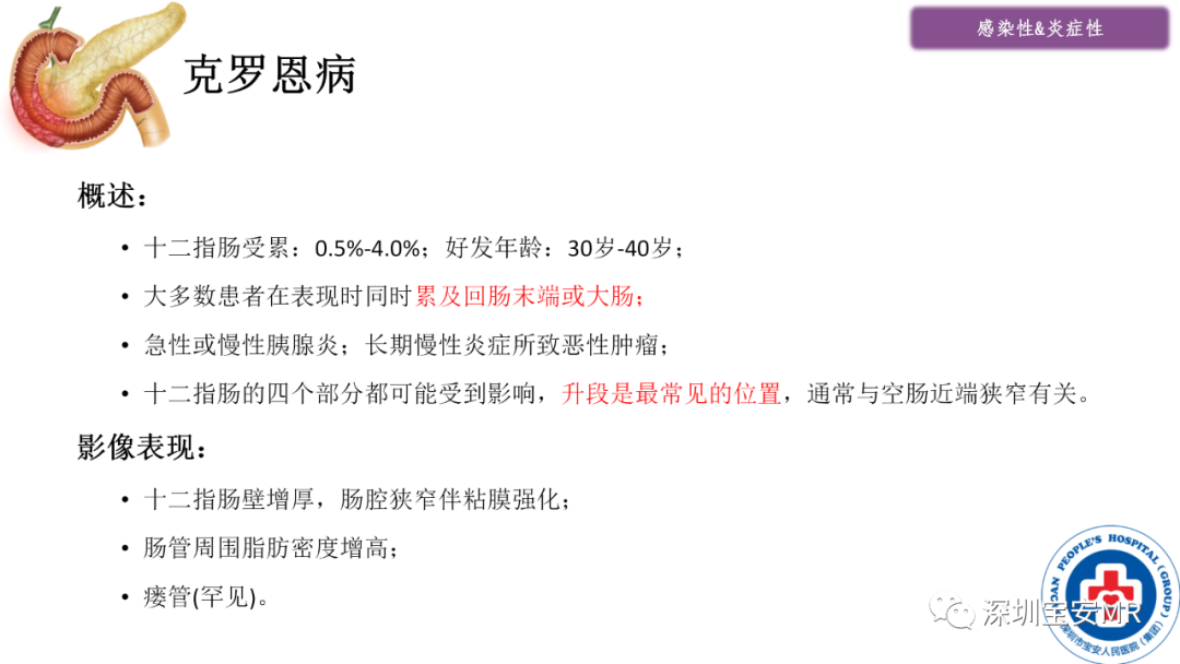 影像PPT - 【PPT】十二指肠疾病影像表现-11