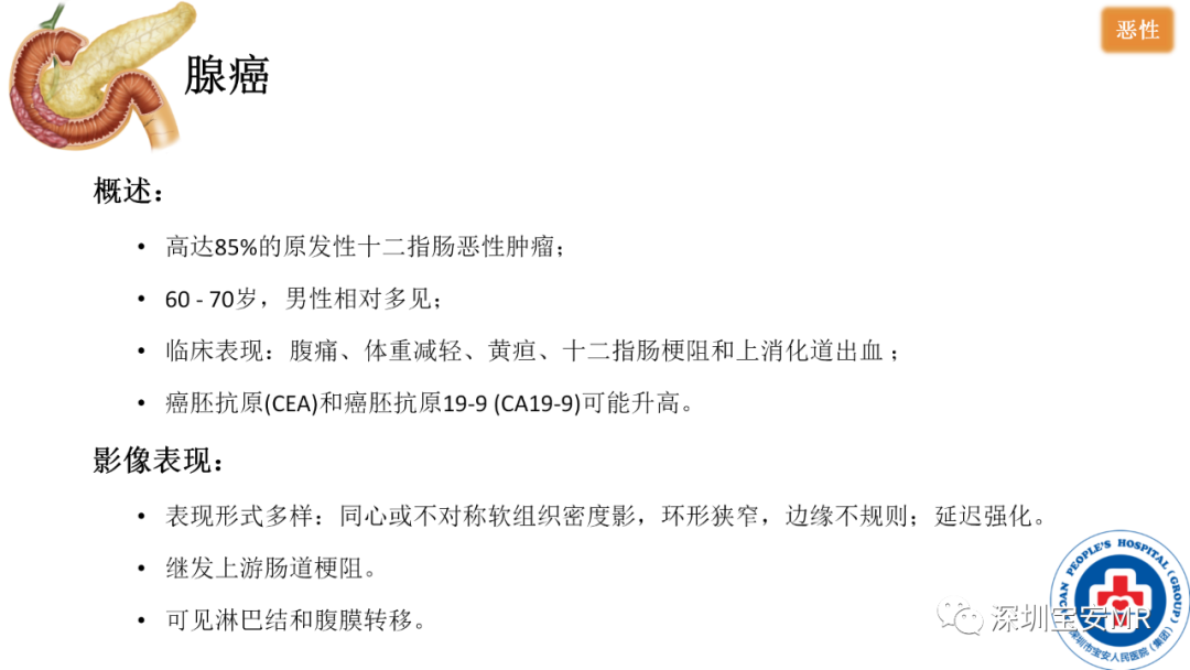 影像PPT - 【PPT】十二指肠疾病影像表现-15