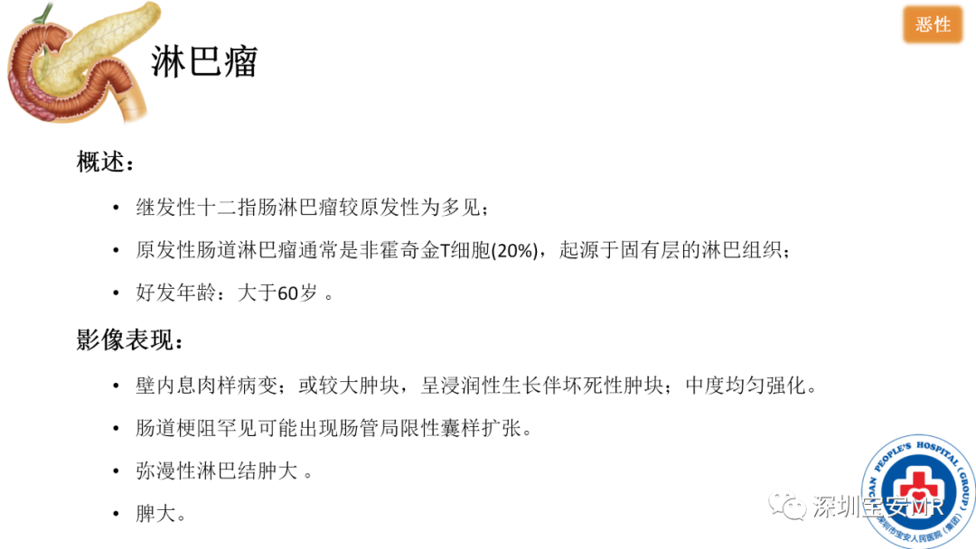 影像PPT - 【PPT】十二指肠疾病影像表现-17