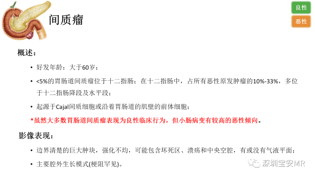 影像PPT - 【PPT】十二指肠疾病影像表现-21