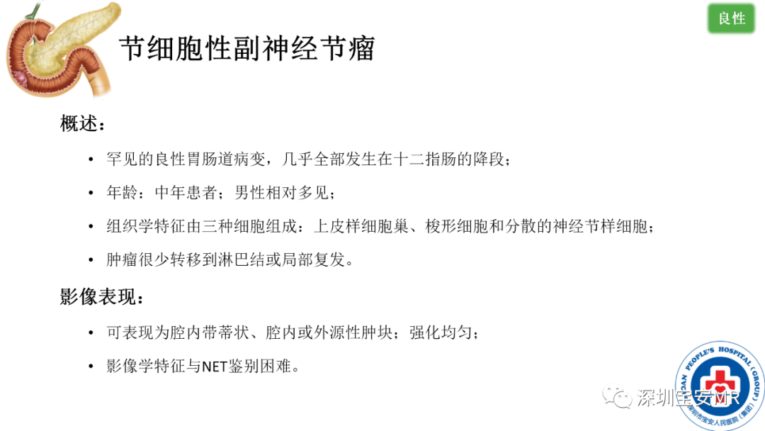 影像PPT - 【PPT】十二指肠疾病影像表现-25