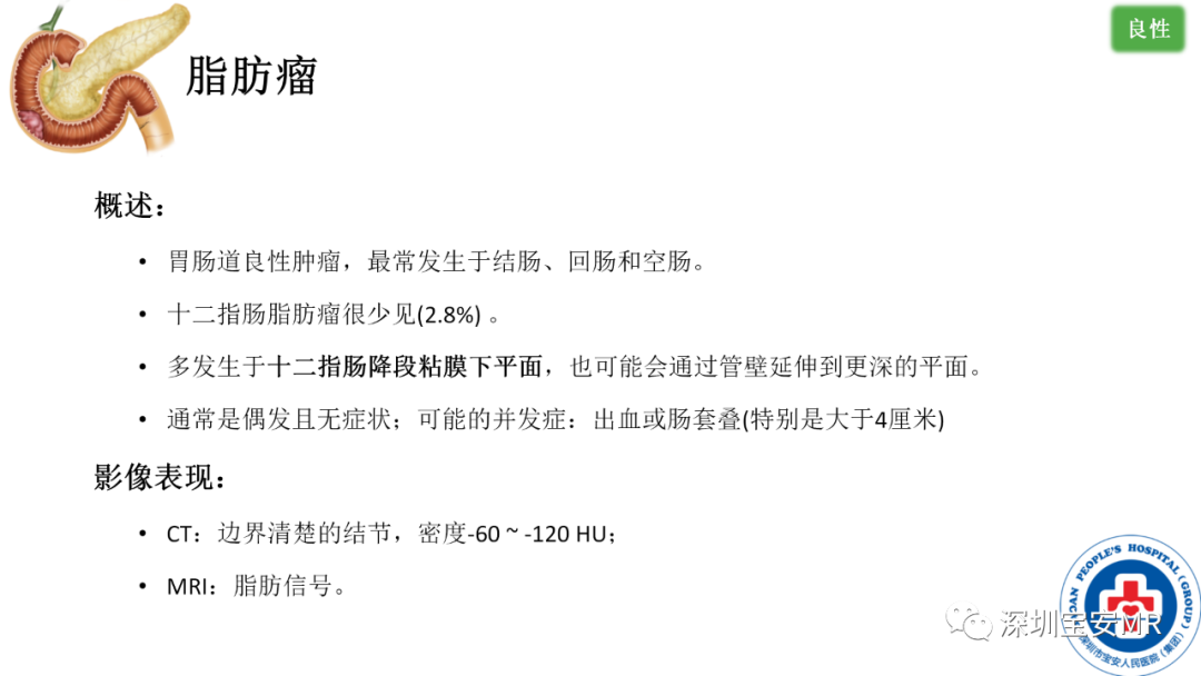 影像PPT - 【PPT】十二指肠疾病影像表现-27