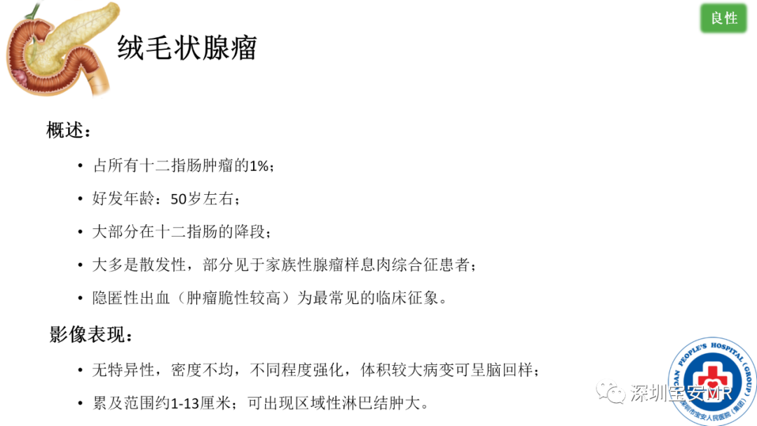 影像PPT - 【PPT】十二指肠疾病影像表现-29