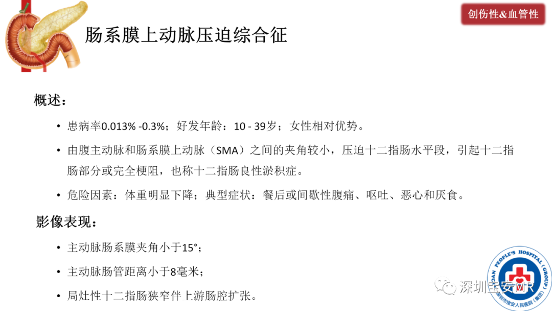 影像PPT - 【PPT】十二指肠疾病影像表现-33