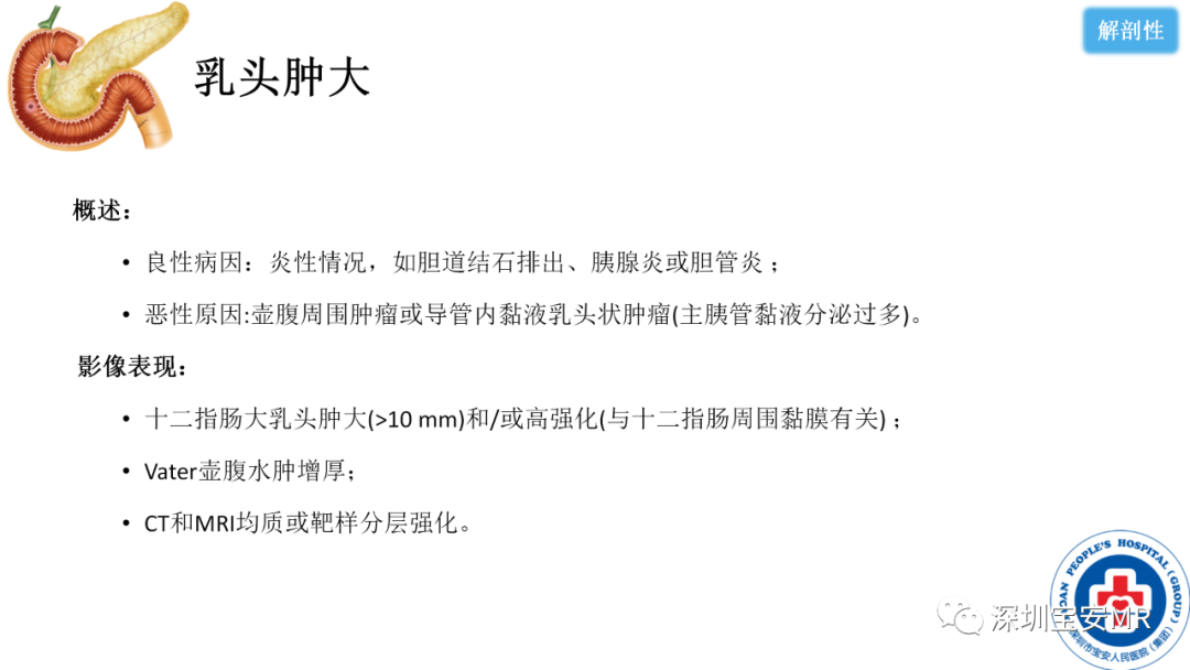 影像PPT - 【PPT】十二指肠疾病影像表现-35