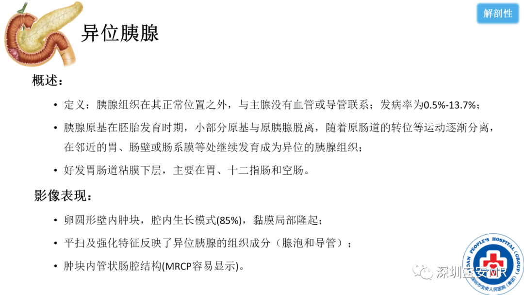 影像PPT - 【PPT】十二指肠疾病影像表现-37