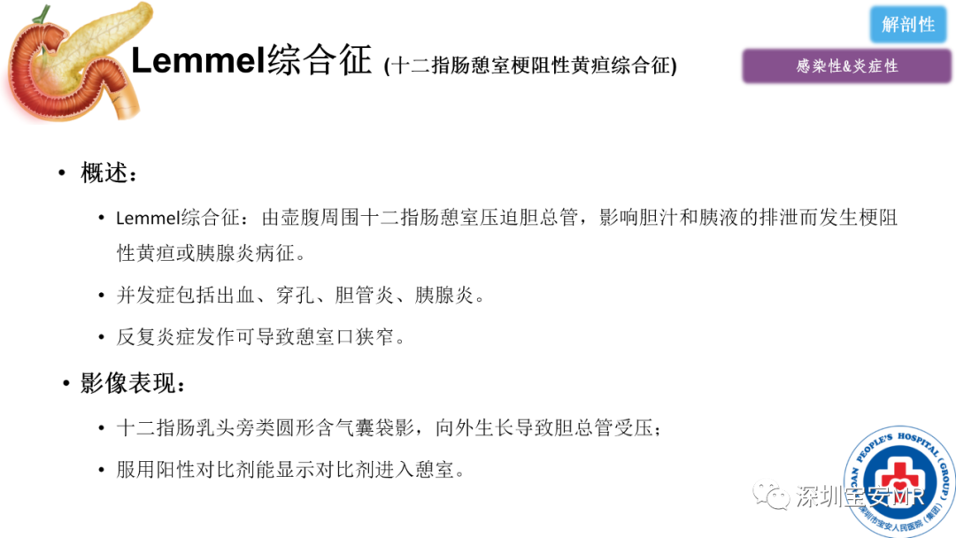 影像PPT - 【PPT】十二指肠疾病影像表现-41