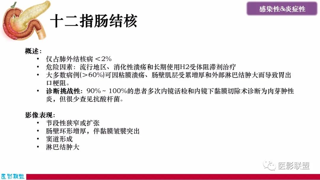 影像PPT - 【PPT】十二指肠断面成像：疾病谱-5