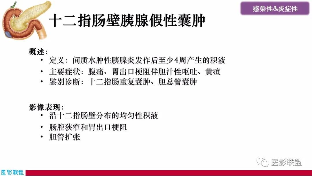 影像PPT - 【PPT】十二指肠断面成像：疾病谱-9
