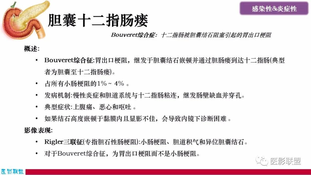 影像PPT - 【PPT】十二指肠断面成像：疾病谱-15