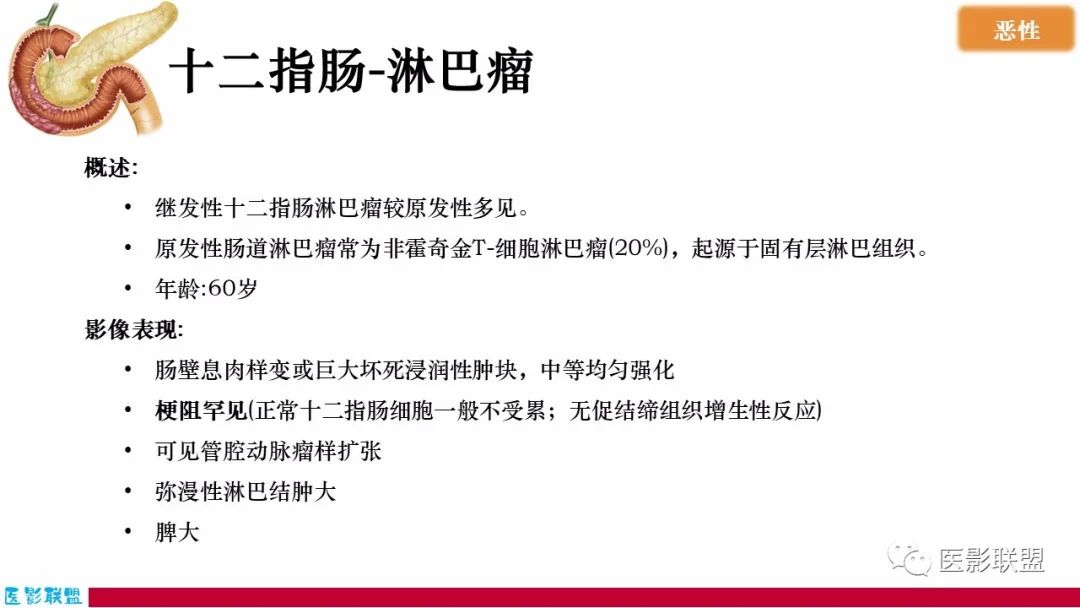 影像PPT - 【PPT】十二指肠断面成像：疾病谱-21
