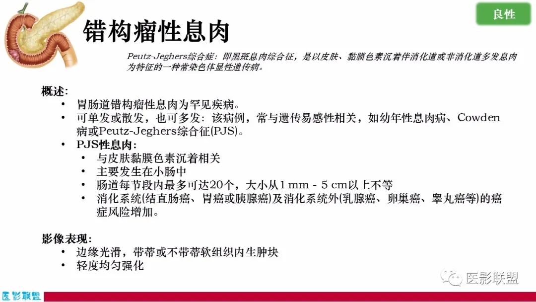 影像PPT - 【PPT】十二指肠断面成像：疾病谱-31