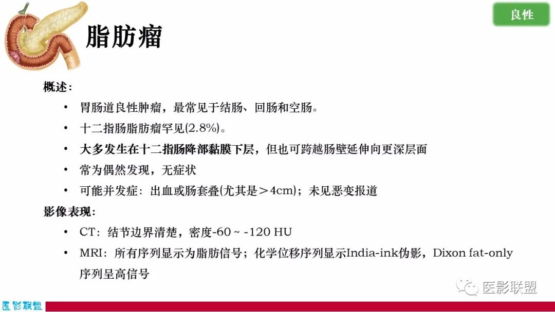 影像PPT - 【PPT】十二指肠断面成像：疾病谱-33