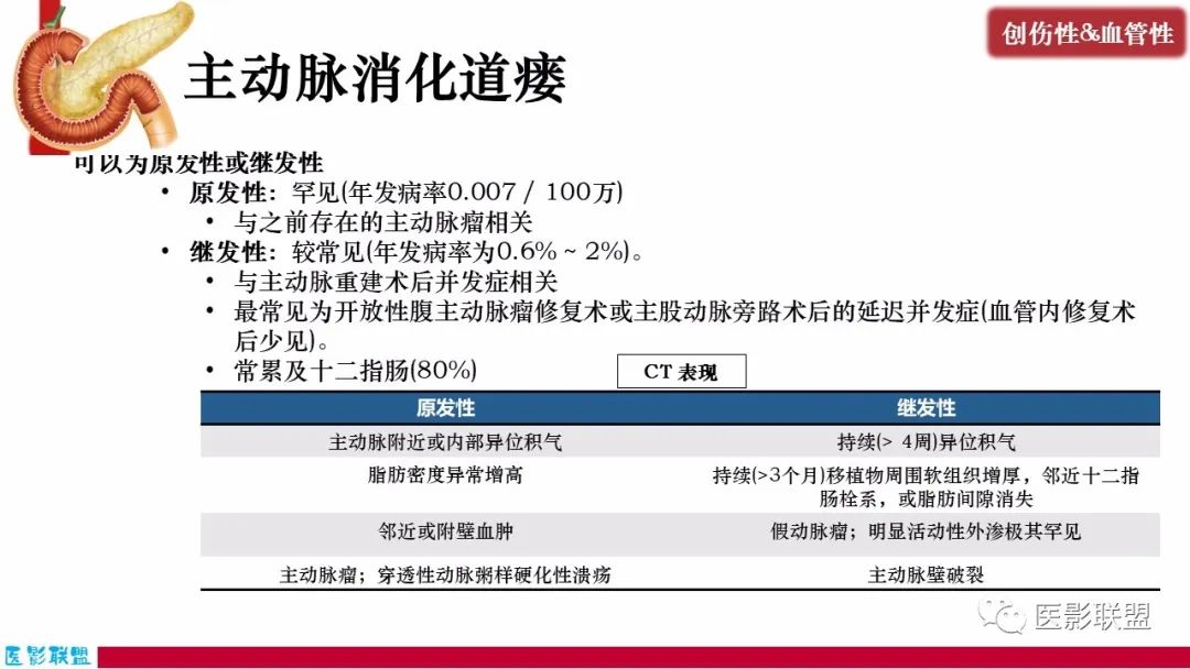 影像PPT - 【PPT】十二指肠断面成像：疾病谱-43