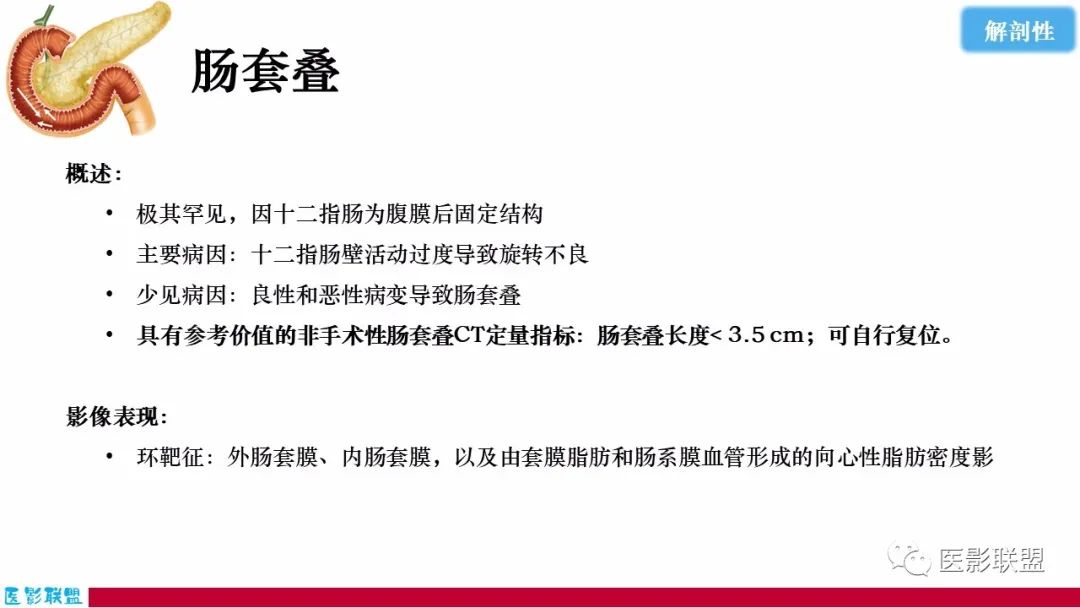 影像PPT - 【PPT】十二指肠断面成像：疾病谱-51