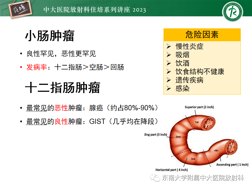影像PPT - 【PPT】常见十二指肠占位影像诊断-2