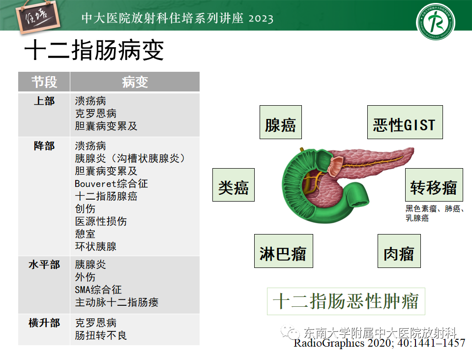 影像PPT - 【PPT】常见十二指肠占位影像诊断-4