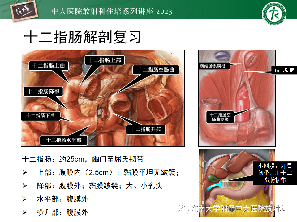 影像PPT - 【PPT】常见十二指肠占位影像诊断-3