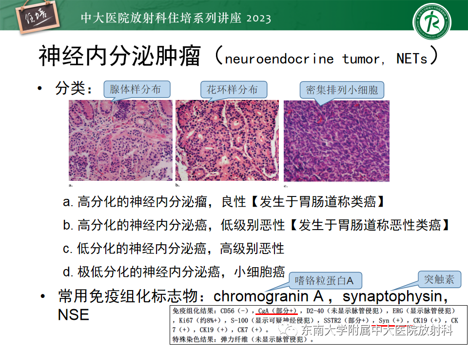 影像PPT - 【PPT】常见十二指肠占位影像诊断-9