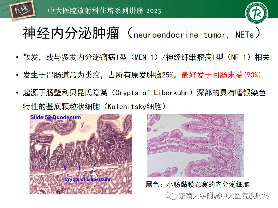 影像PPT - 【PPT】常见十二指肠占位影像诊断-10